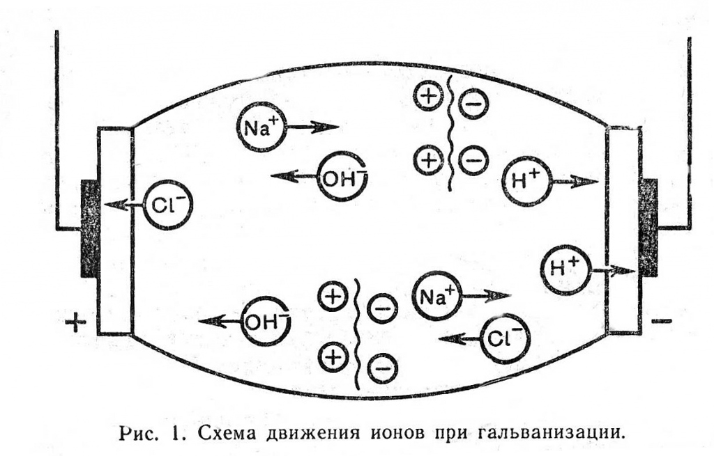 Схема гальванизации